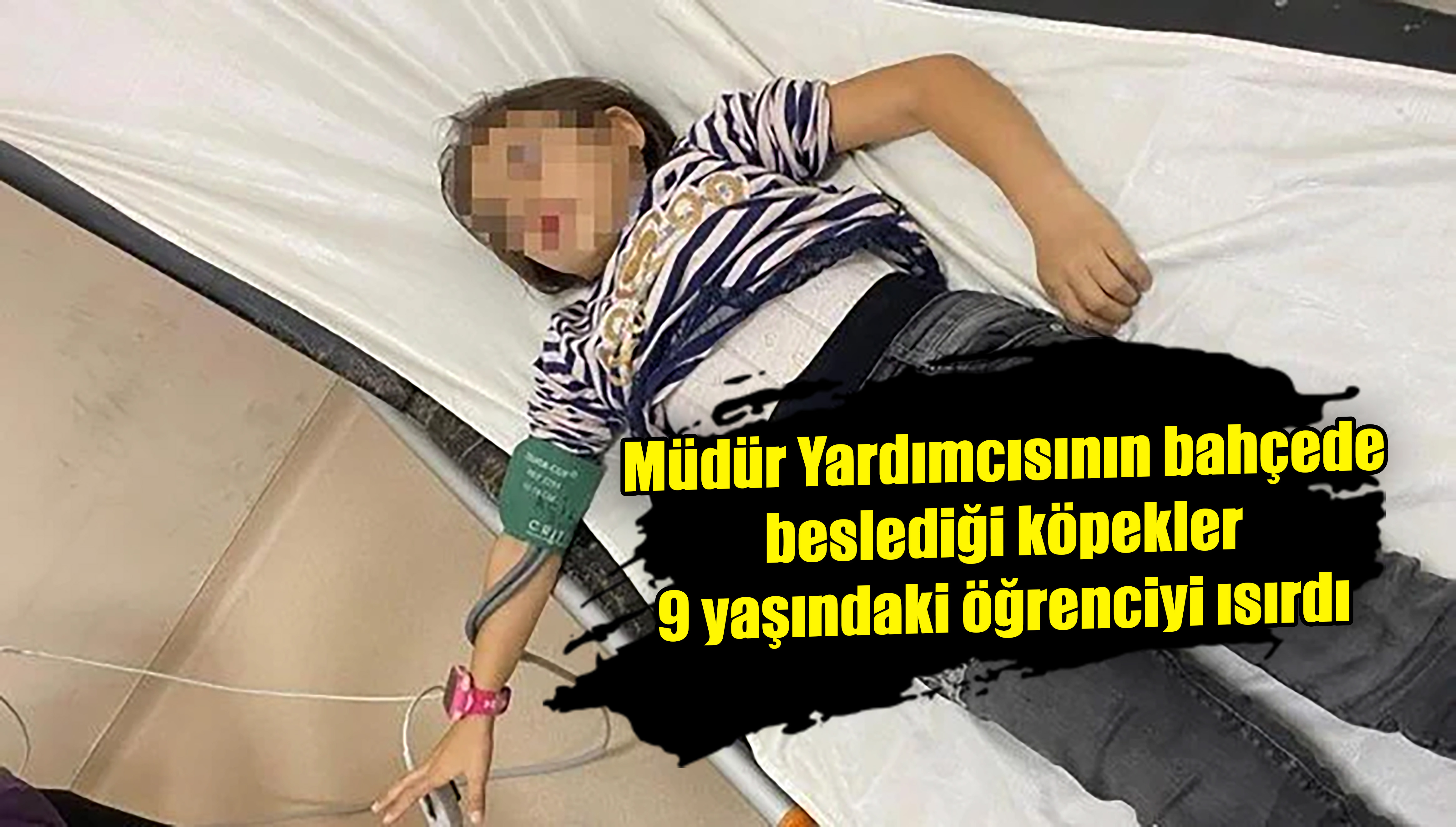 Müdür Yardımcısının bahçede beslediği köpekler 9 yaşındaki öğrenciyi ısırdı